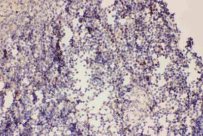 2 - Anti-FOXP3 Antibody ABO12717