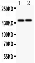 1 - Anti-Collagen III Antibody ABO12718