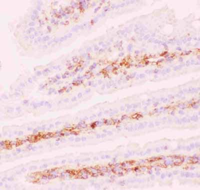 2 - Anti-P GlycoProtein Antibody ABO12719