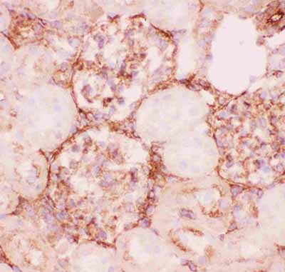 2 - Anti-P GlycoProtein Antibody ABO12719
