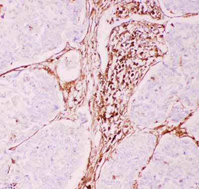 2 - Anti-P GlycoProtein Antibody ABO12719
