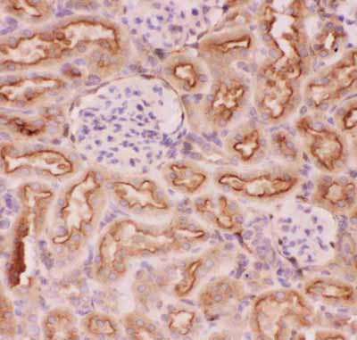 2 - Anti-P GlycoProtein Antibody ABO12719