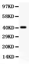 1 - Anti-SCP3 Antibody ABO12720