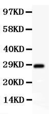 1 - Anti-SCP3 Antibody ABO12720
