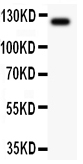1 - Anti-TIE2 Antibody ABO12721
