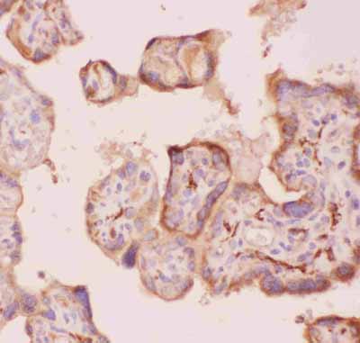 2 - Anti-Angiopoietin-2 Antibody ABO12722