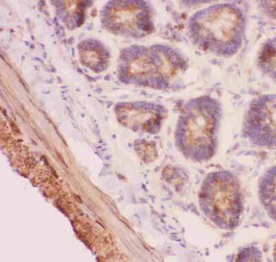 2 - Anti-Angiopoietin-2 Antibody ABO12722