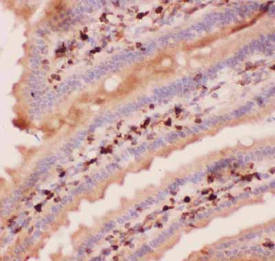 2 - Anti-Angiopoietin-2 Antibody ABO12722
