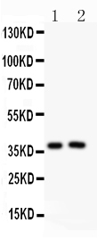 1 - Anti-PD-1 Antibody ABO12724