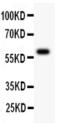 1 - Anti-ATM Antibody ABO12725