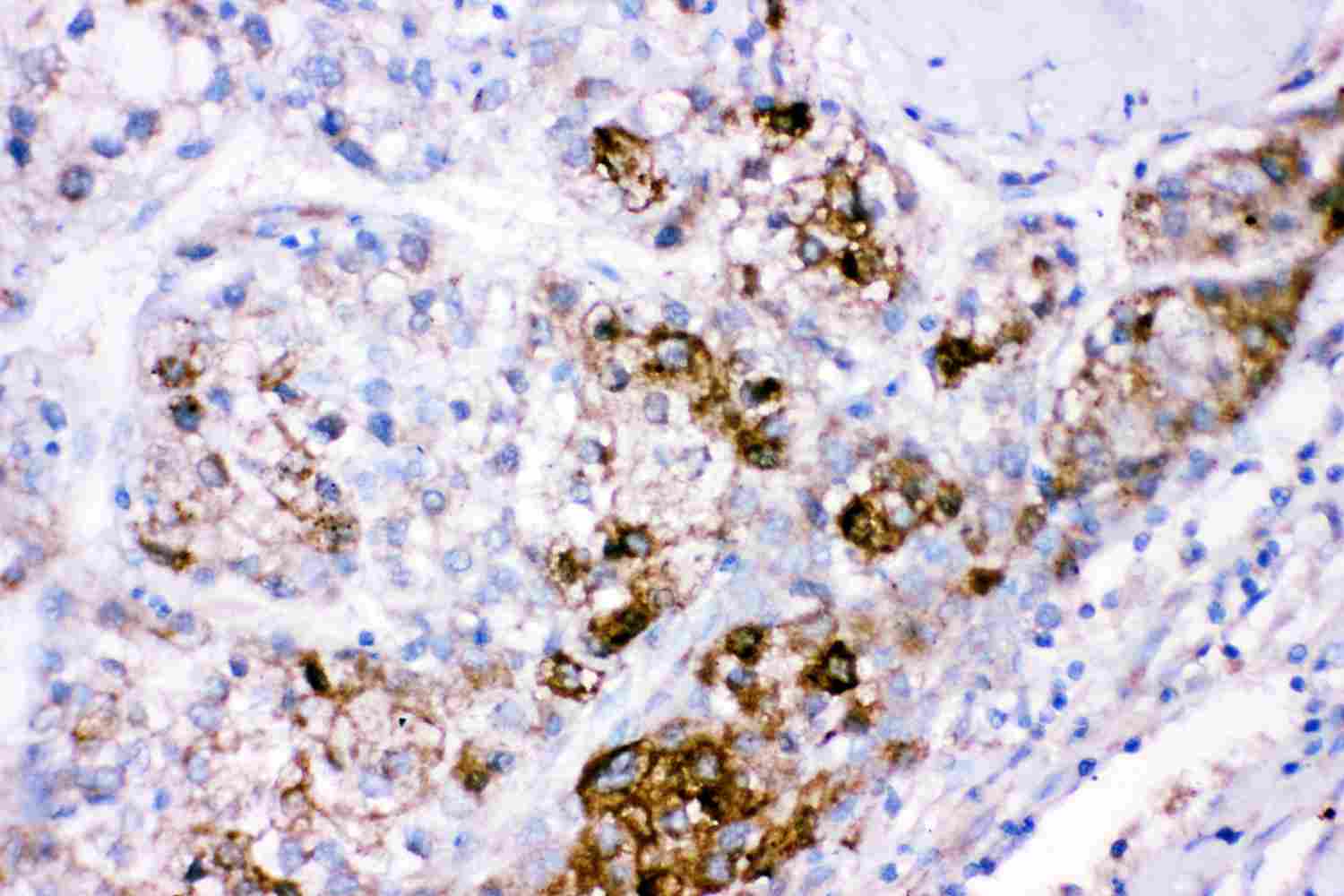 2 - Anti-CBS Antibody ABO12726