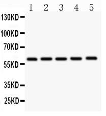 1 - Anti-CBS Antibody ABO12726