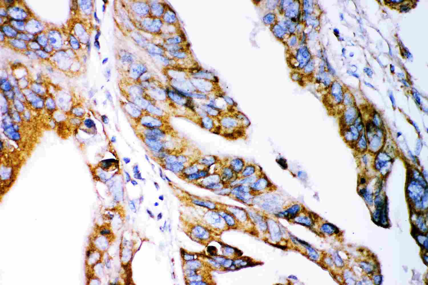 2 - Anti-Claudin 2 Antibody ABO12727