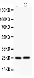 1 - Anti-Claudin 2 Antibody ABO12727