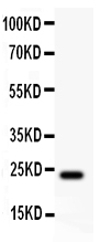 1 - Anti-Claudin 5 Antibody ABO12728