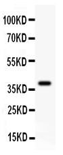 1 - Anti-Dicer Antibody ABO12729