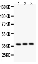1 - Anti-IL-3 Antibody ABO12730