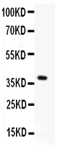 1 - Anti-MBD2 Antibody ABO12732