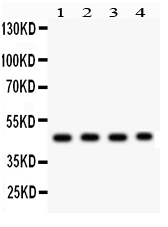 1 - Anti-MBD2 Antibody ABO12732