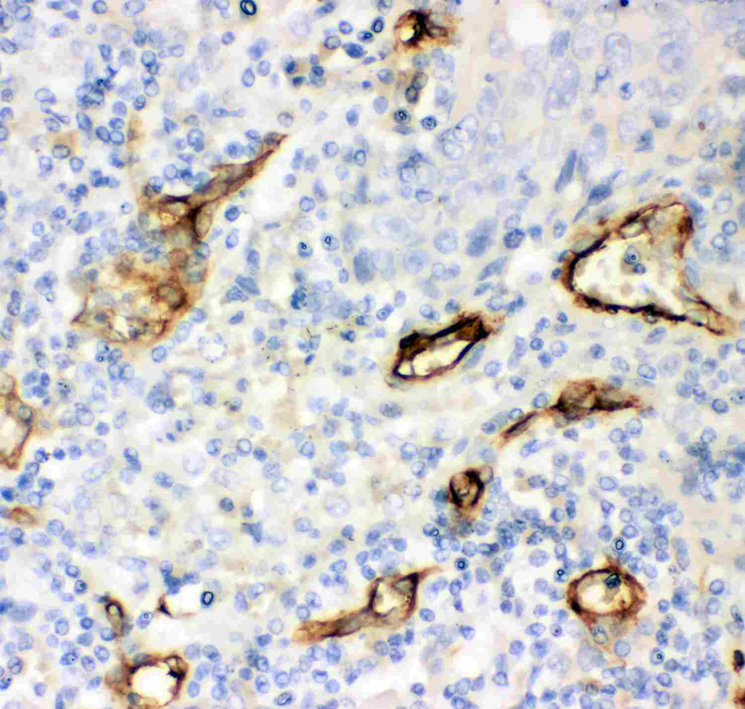 2 - Anti-CD146 Antibody ABO12733