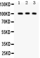 1 - Anti-CD146 Antibody ABO12733