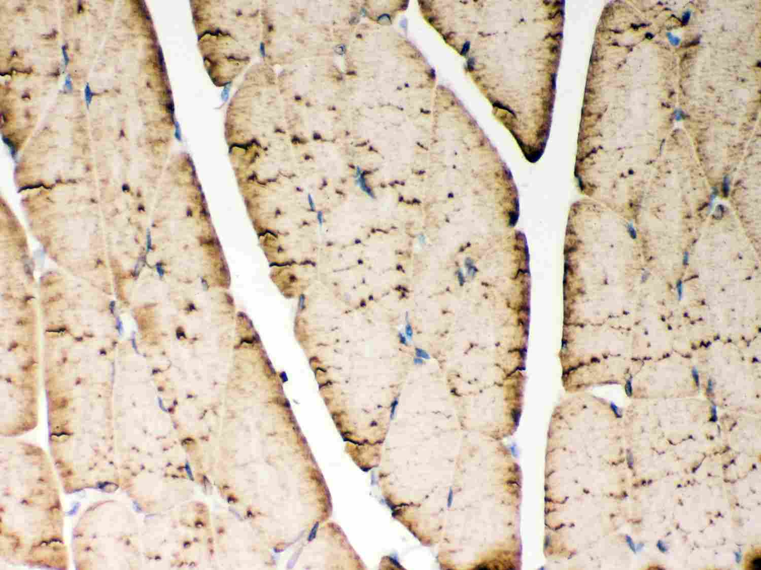 2 - Anti-SERCA1 ATPase Antibody ABO12736
