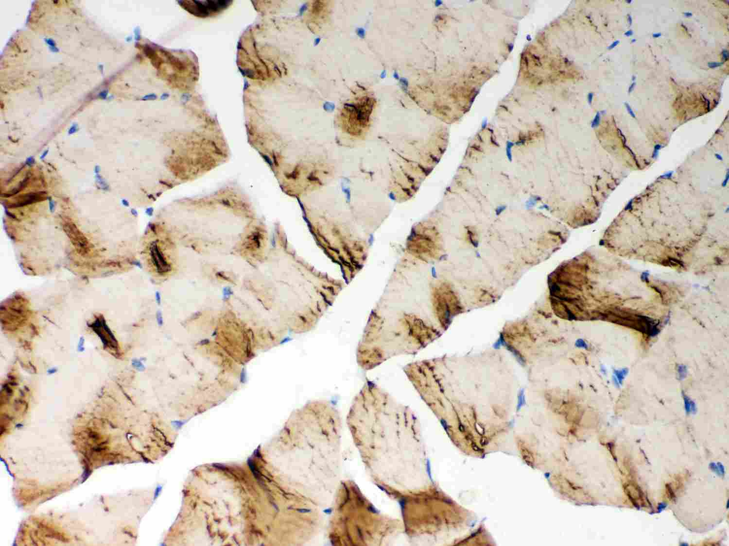 2 - Anti-SERCA1 ATPase Antibody ABO12736