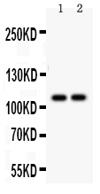 1 - Anti-SERCA1 ATPase Antibody ABO12736