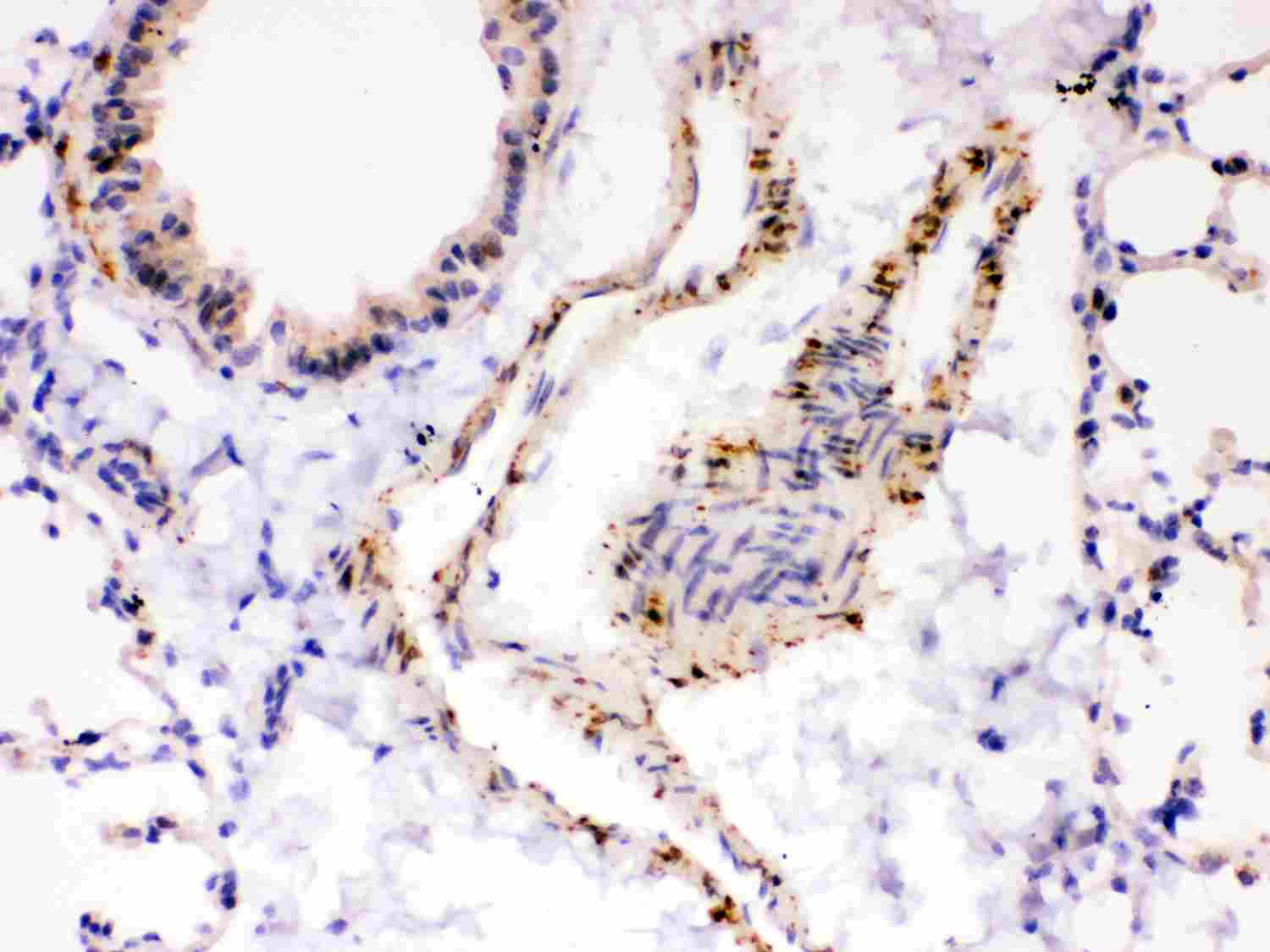 2 - Anti-SERCA2 ATPase Antibody ABO12737