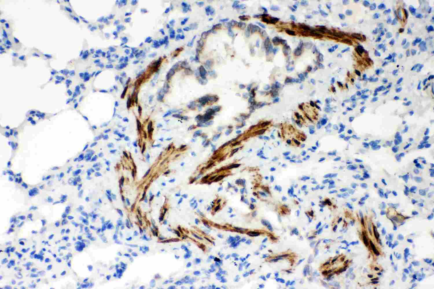 2 - Anti-SERCA2 ATPase Antibody ABO12737