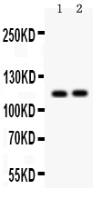 1 - Anti-SERCA2 ATPase Antibody ABO12737