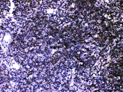 2 - Anti-ATP2A3 Antibody ABO12738