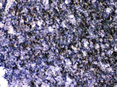 2 - Anti-ATP2A3 Antibody ABO12738