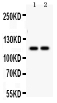 1 - Anti-ATP2A3 Antibody ABO12738