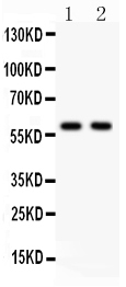 1 - Anti-KAT13A/SRC1 Antibody ABO12739