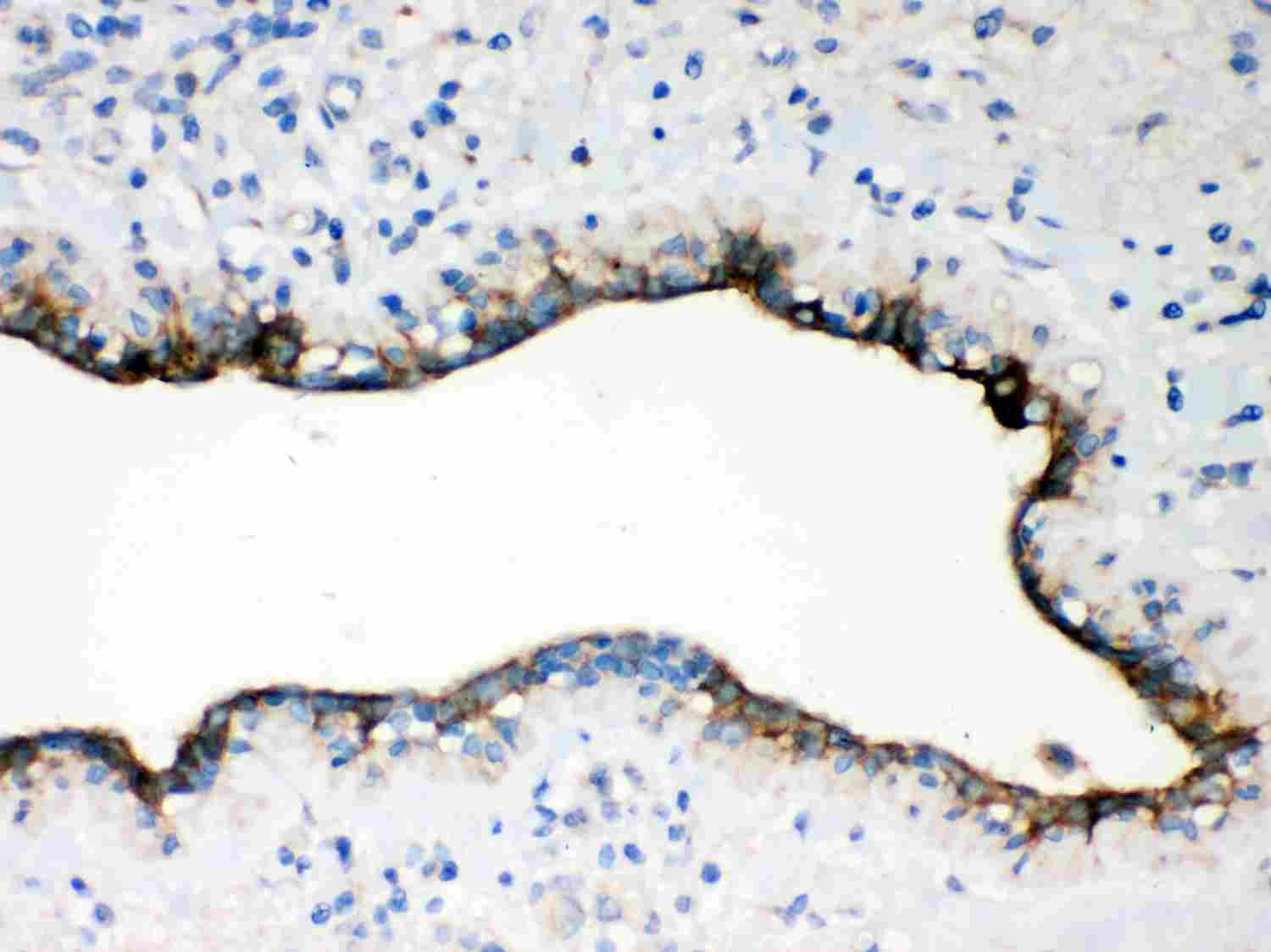 2 - Anti-Occludin Antibody ABO12740