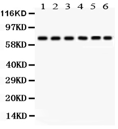 1 - Anti-PKC Delta Antibody ABO12741