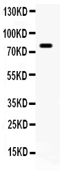 1 - Anti-FE65 Antibody ABO12742