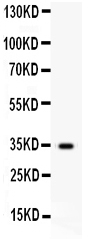 1 - Anti-HGF Antibody ABO12743