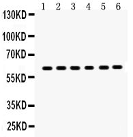 1 - Anti-EAAT2 Antibody ABO12744