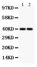 1 - Anti-SFRP4 Antibody ABO12746