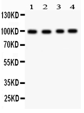 1 - Anti-Synaptopodin Antibody ABO12748