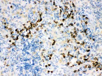 2 - Anti-Actin Antibody ABO12749