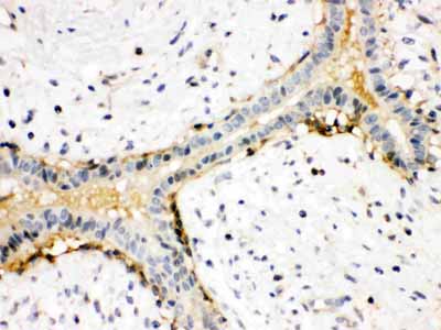 2 - Anti-Actin Antibody ABO12749