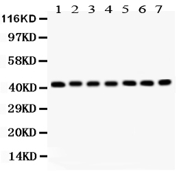 1 - Anti-Actin Antibody ABO12749