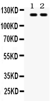 1 - Anti-TLR8 Antibody ABO12752