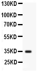 1 - Anti-liver Arginase Antibody ABO12753