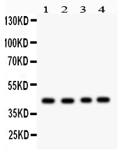 1 - Anti-TSG101 Antibody ABO12756