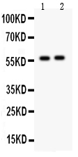 1 - Anti-CYP7A1 Antibody ABO12757
