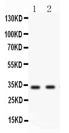 1 - Anti-Livin Antibody ABO12759